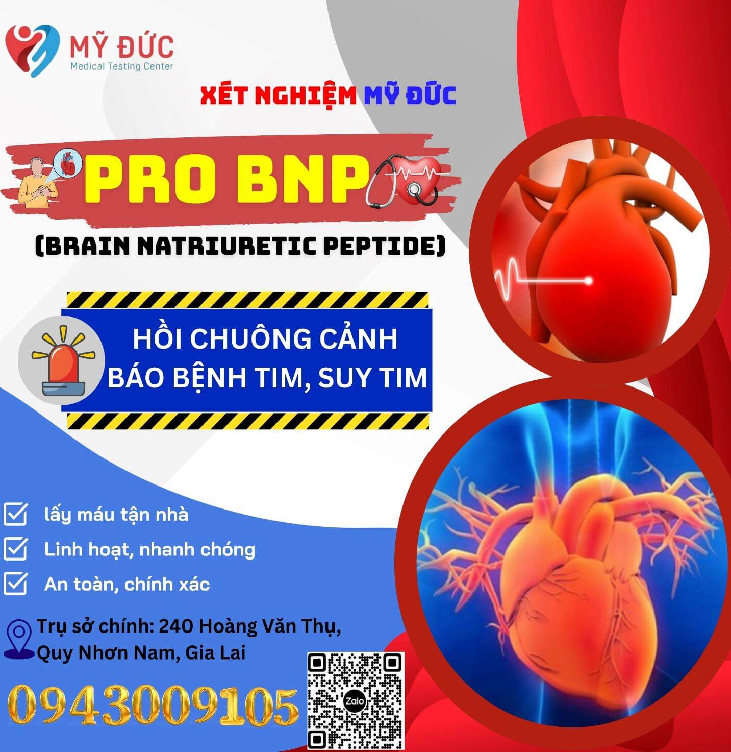 gia-tri-xet-nghiem-nt-probnp-trong-chan-doan-theo-doi-tien-luong-va-sang-loc-suy-tim-4
