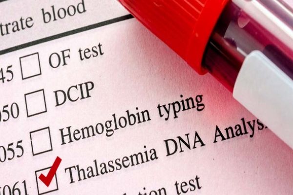 Gói xét nghiệm sàng lọc bệnh Thalassemia