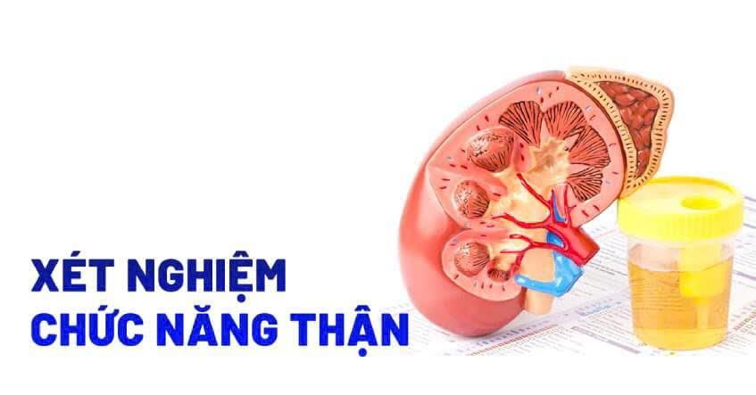 Lưu ý khi xét nghiệm chức năng thận