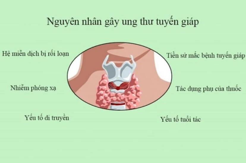 nhung dau hieu ung thu tuyen giap ban can luu y 3