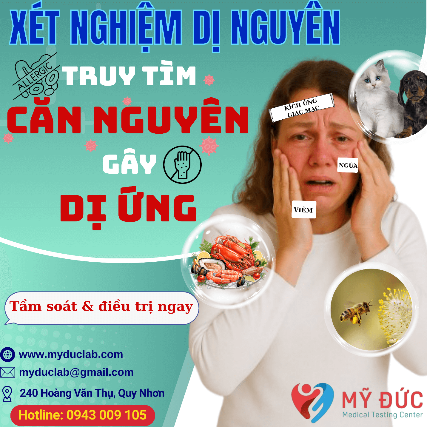 xet-nghiem-91-di-nguyen-cach-phat-hien-va-dieu-tri-di-ung-hieu-qua-4