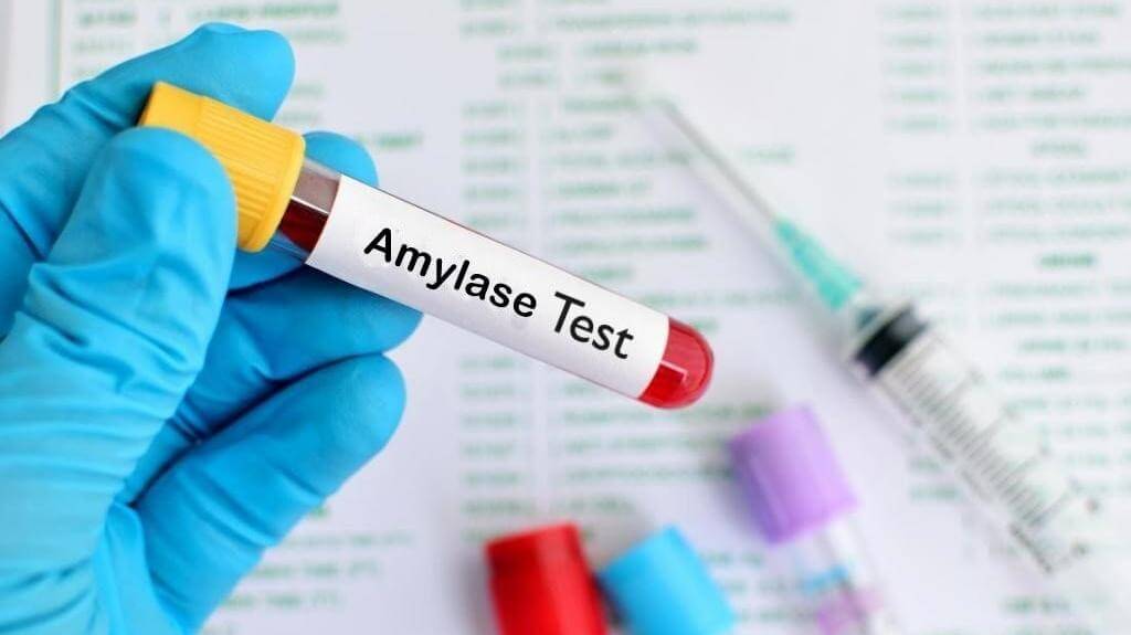 Xét nghiệm Amylase là gì? Ý nghĩa của các giá trị nồng độ Amylase