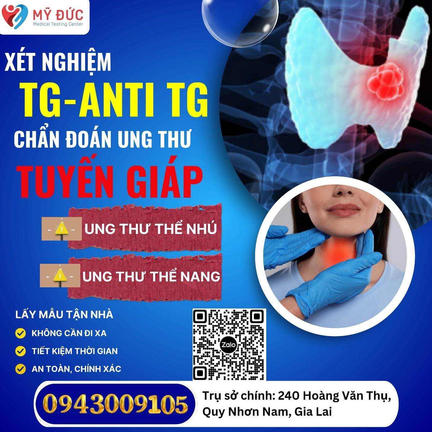 xet-nghiem-anti-tg-giup-theo-doi-va-dieu-tri-ung-thu-tuyen-giap-2