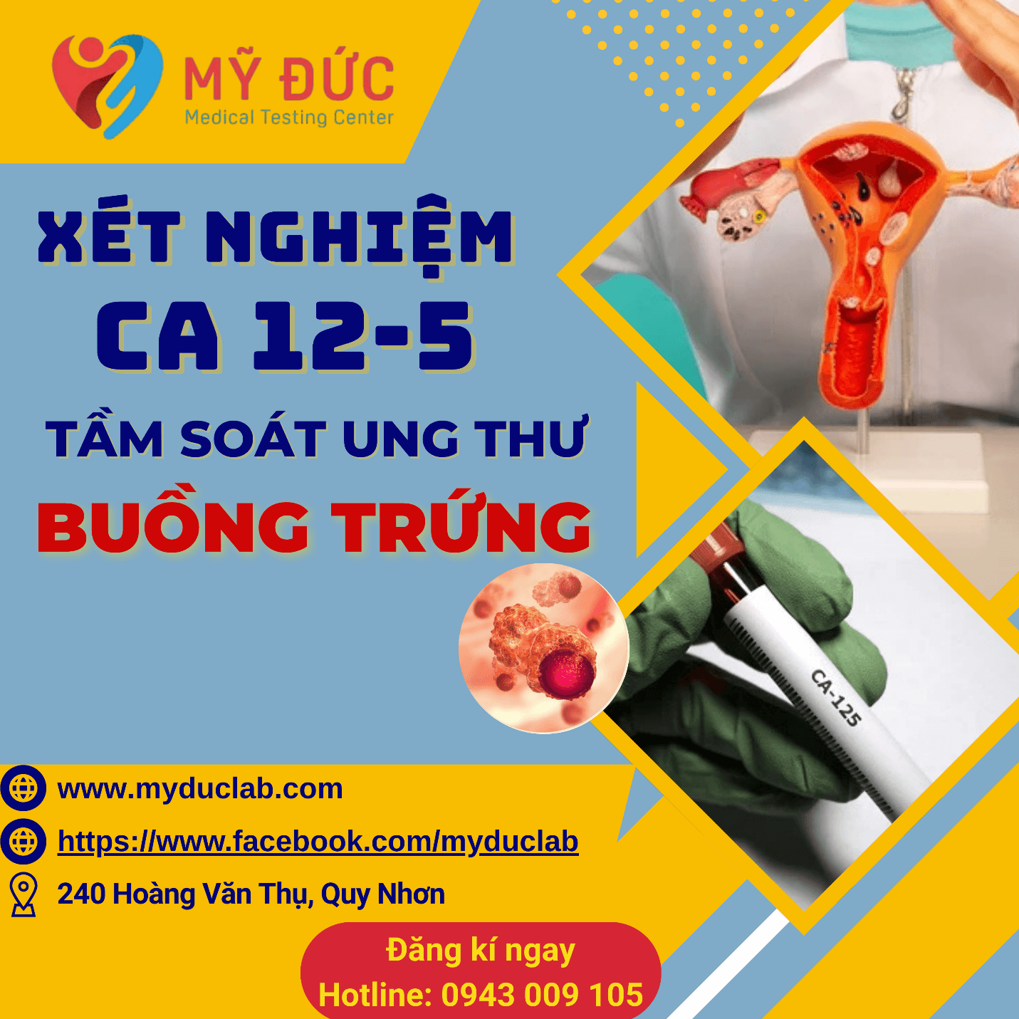 xet-nghiem-ca-125-ung-thu-buong-trung-3