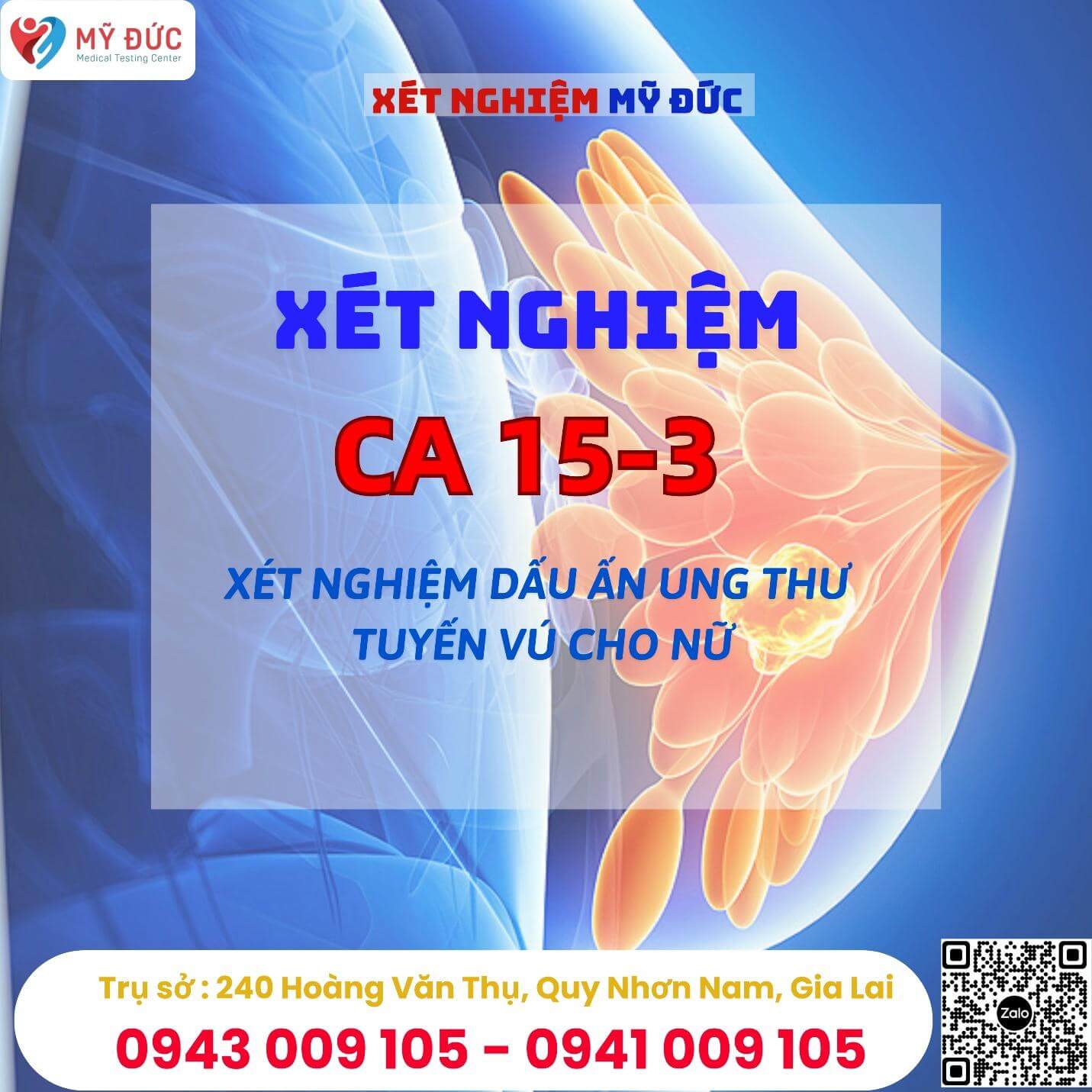 xet-nghiem-ca-15-3-dau-an-ung-thu-vu-4