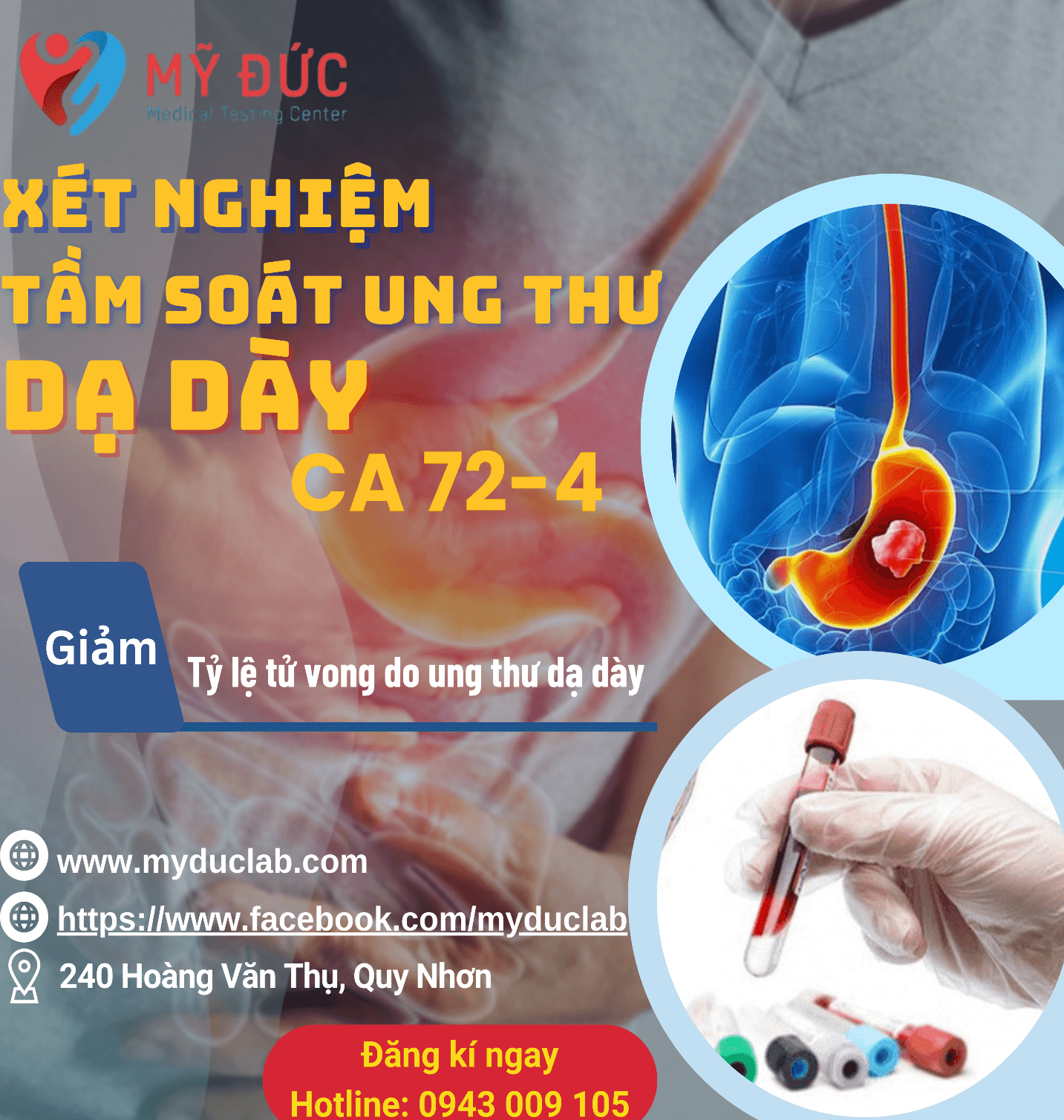xet-nghiem-ca-72-4-trong-chan-doan-ung-thu-da-day