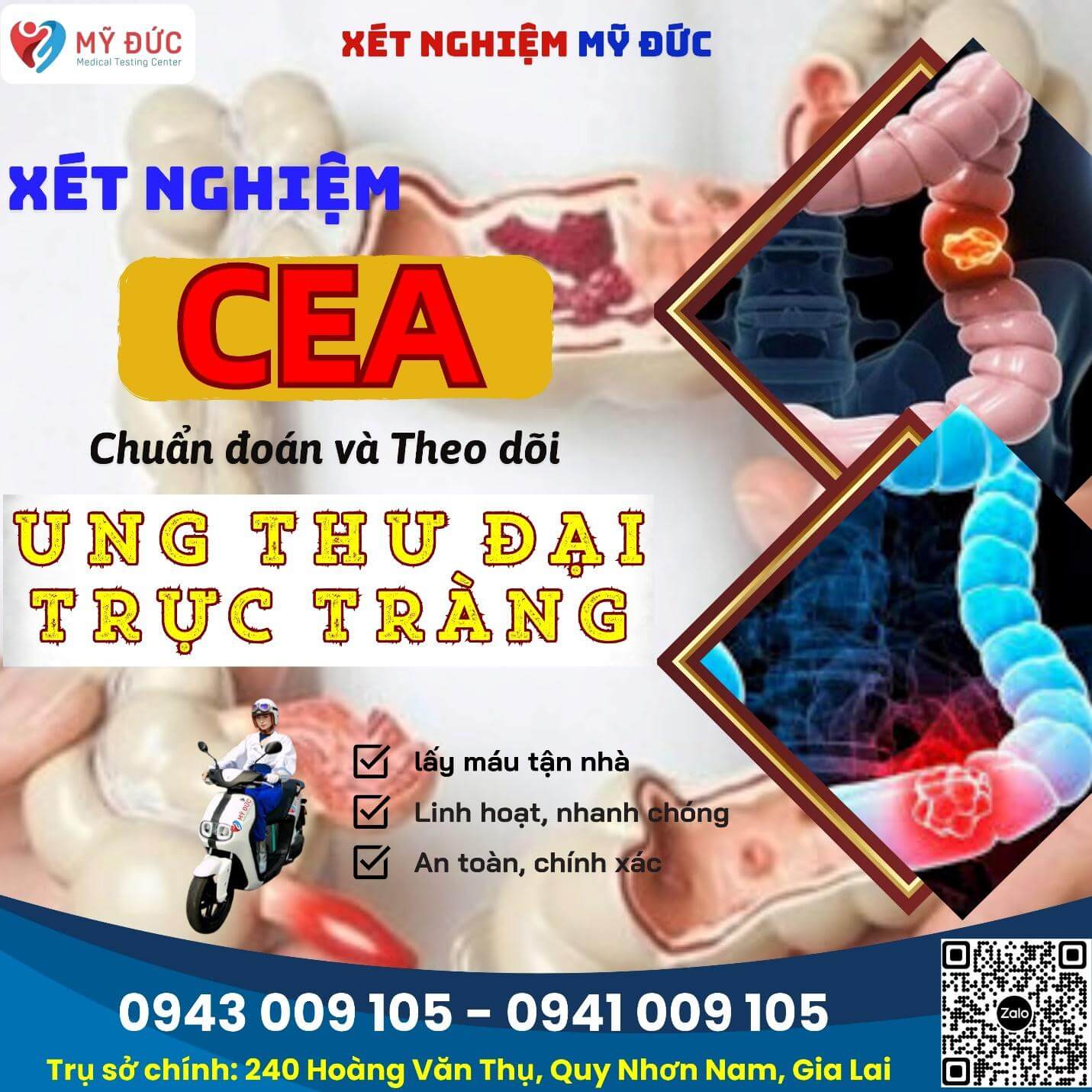 xet-nghiem-cea-trong-ung-thu-dai-truc-trang-4