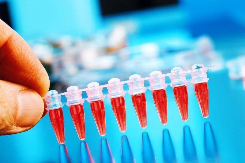 Xét nghiệm D-Dimer là gì? Ý nghĩa và cách đọc kết quả