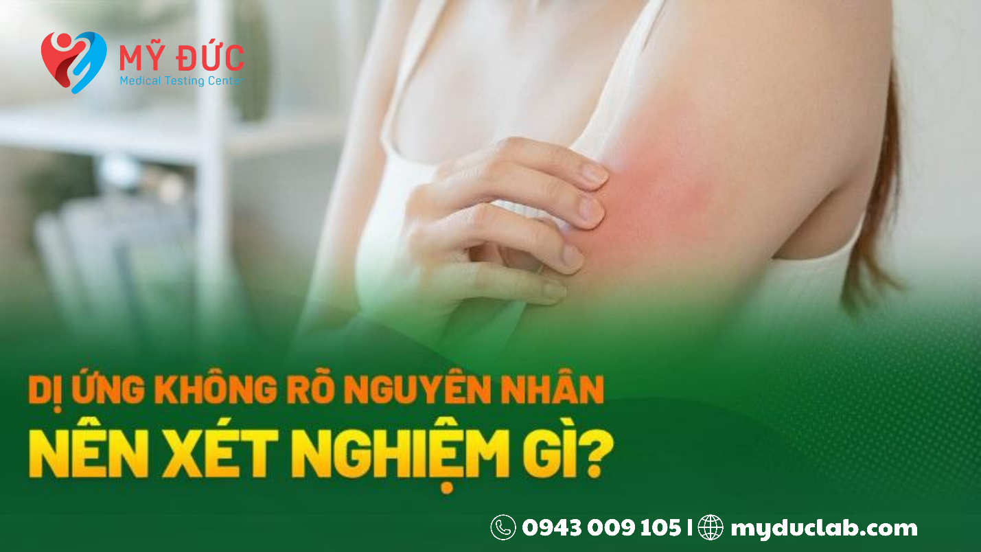 Xét nghiệm dị nguyên là gì? Khi nào cần xét nghiệm dị nguyên?