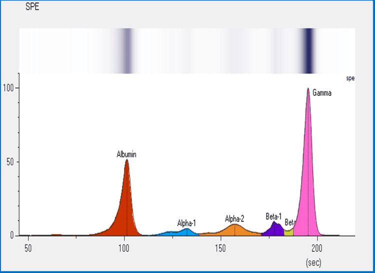 xet-nghiem-dien-di-protein-huyet-thanh