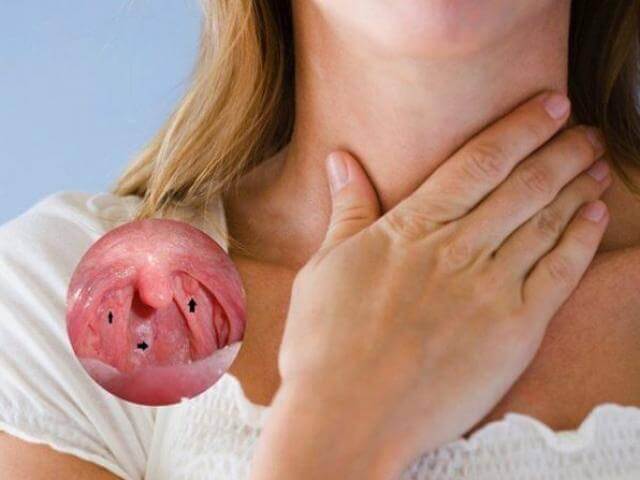 xet-nghiem-ebv-giup-phat-hien-virus-ebv-co-trong-mau