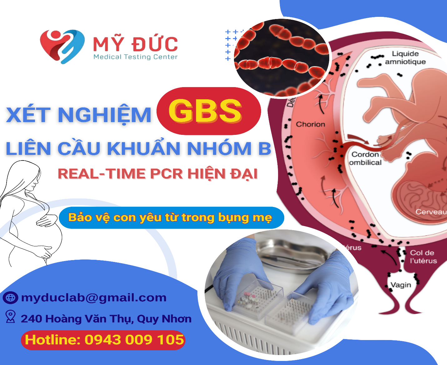 xet-nghiem-gbs-lien-cau-khuan-nhom-b-realtime-pcr-hien-dai-4
