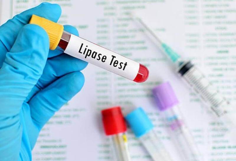 xet-nghiem-lipase-nham-muc-dich-gi-mot-so-dieu-can-biet-ve-xet-nghiem-lipase-2