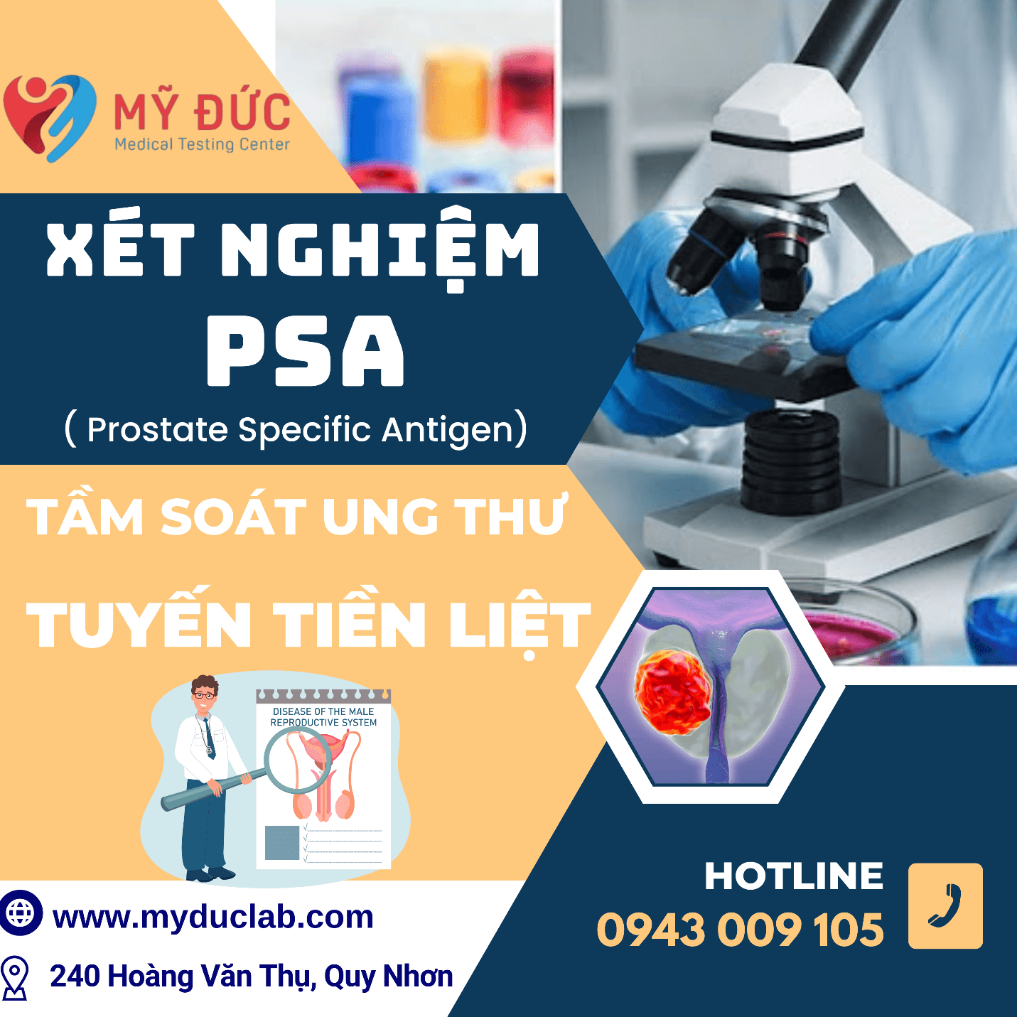 xet-nghiem-psa-tam-soat-ung-thu-tuyen-tien-liet-3