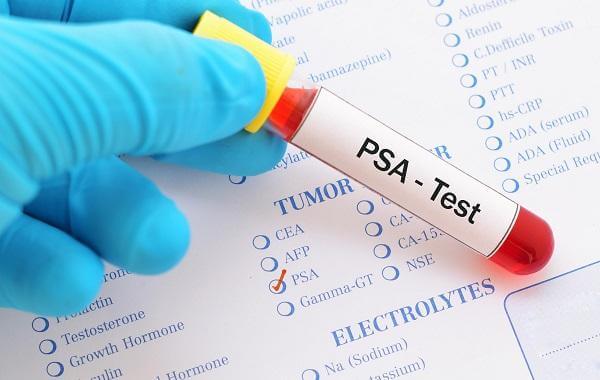 Xét nghiệm PSA tầm soát ung thư tuyến tiền liệt