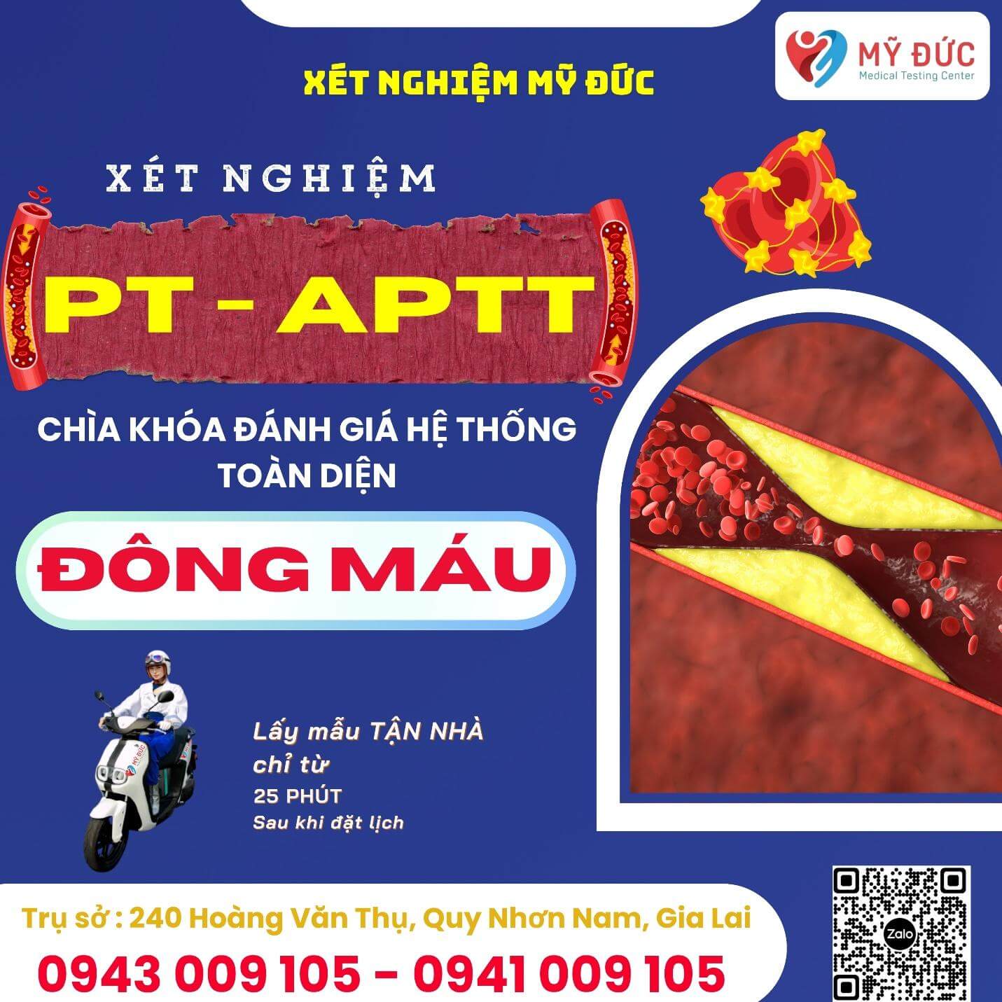 xet-nghiem-thromboplastin-mot-phan-hoat-hoa-aptt-3